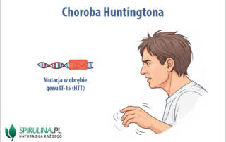 Choroba Huntingtona