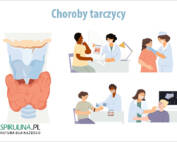 Choroby tarczycy