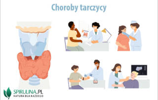 Choroby tarczycy