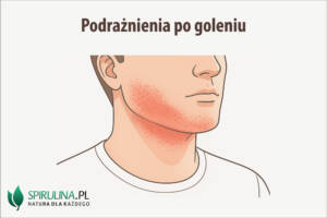 Podrażnienia po goleniu