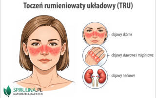 Toczeń rumieniowaty układowy (TRU)
