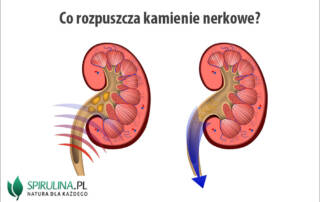 Co rozpuszcza kamienie nerkowe?