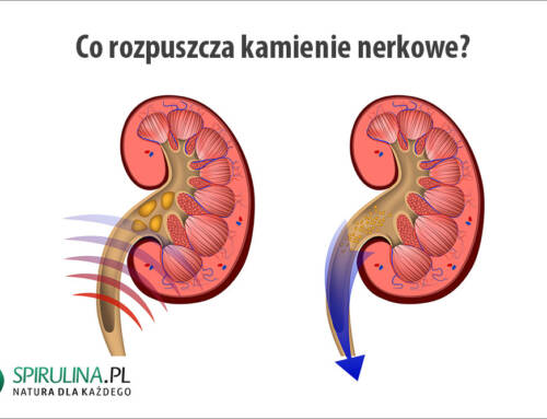 Co rozpuszcza kamienie nerkowe?