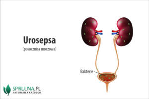 Urosepsa