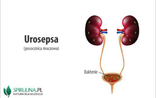 Urosepsa