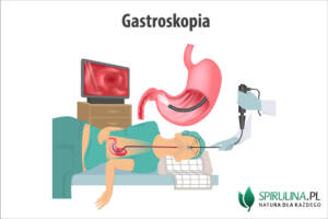 Gastroskopia
