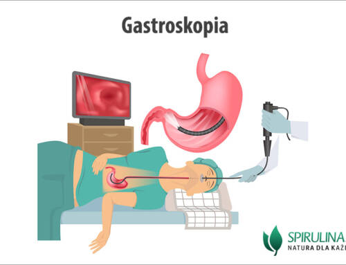 Gastroskopia