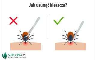 Jak usunąć kleszcza?