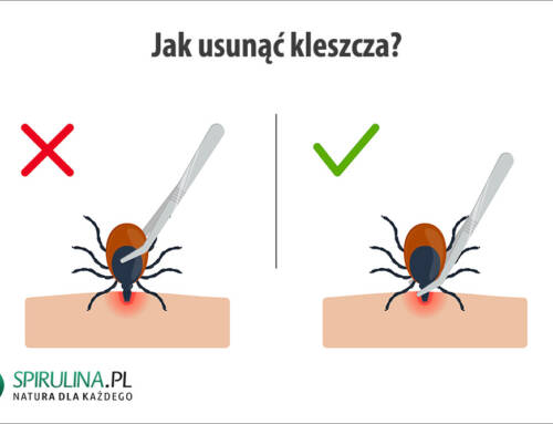 Jak usunąć kleszcza?