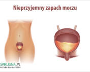 Nieprzyjemny zapach moczu