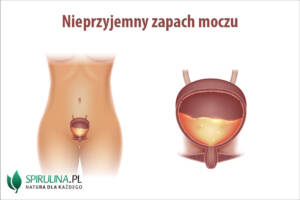 Nieprzyjemny zapach moczu