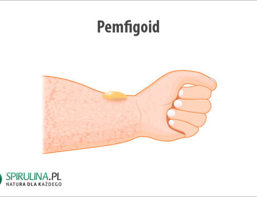 Pemfigoid