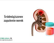 Śródmiąższowe zapalenie nerek