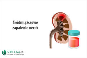 Śródmiąższowe zapalenie nerek