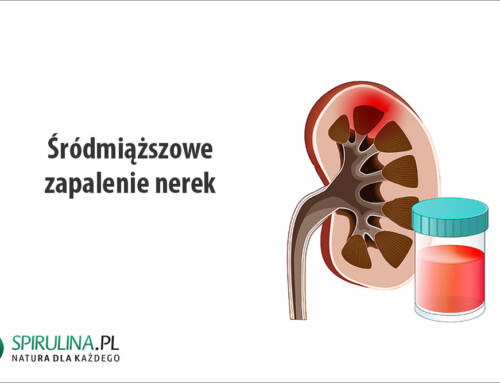 Śródmiąższowe zapalenie nerek