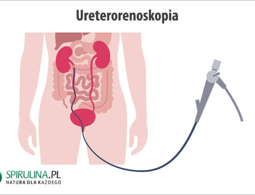 Ureterorenoskopia
