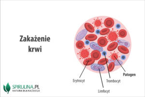 Zakażenie krwi
