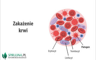 Zakażenie krwi