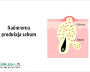 Nadmierna produkcja sebum