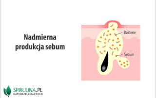 Nadmierna produkcja sebum