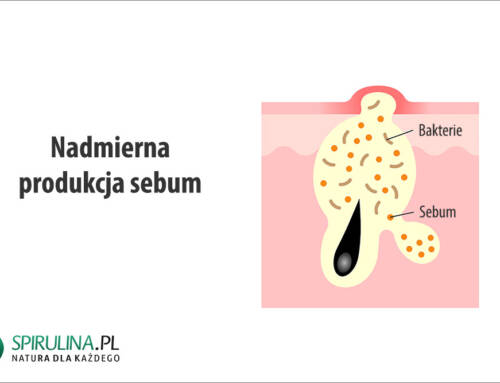 Nadmierna produkcja sebum