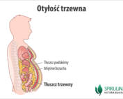 Otyłość trzewna