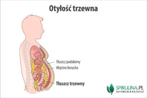 Otyłość trzewna
