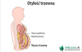 Otyłość trzewna