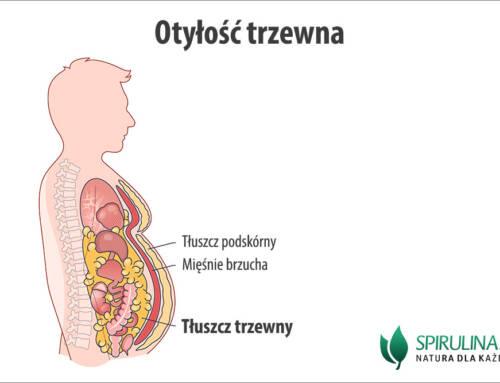 Otyłość trzewna