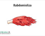 Rabdomioliza