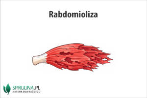 Rabdomioliza