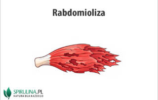 Rabdomioliza