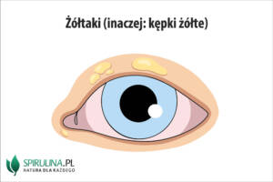 Żółtaki (kępki żółte)