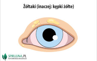 Żółtaki (kępki żółte)
