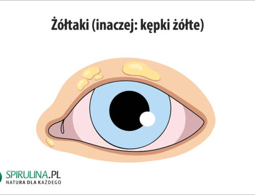 Żółtaki