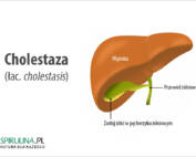 Cholestaza