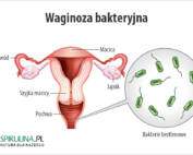 Waginoza bakteryjna