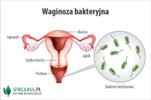 Waginoza bakteryjna