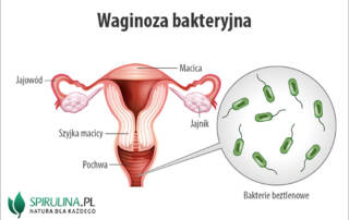 Waginoza bakteryjna