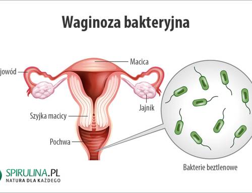Waginoza bakteryjna