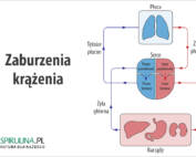 Zaburzenia krążenia