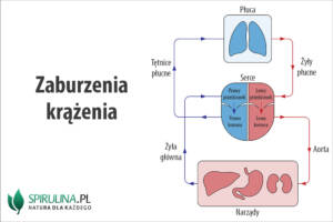 Zaburzenia krążenia