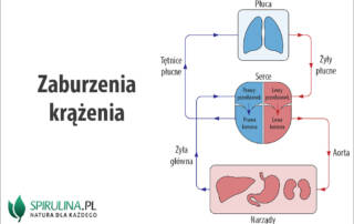 Zaburzenia krążenia