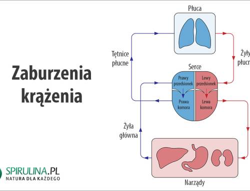Zaburzenia krążenia