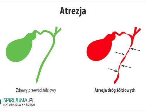 Atrezja