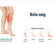 Bóle nóg