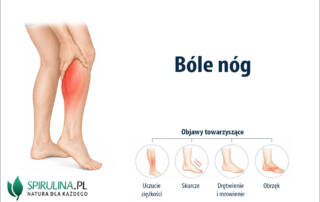 Bóle nóg