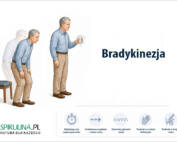Bradykinezja