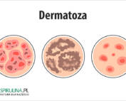 Dermatoza