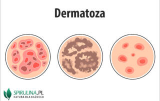 Dermatoza